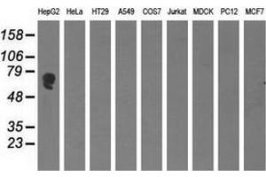Western blot analysis of extracts (35 µg) from 9 different cell lines by using anti-AFP monoclonal antibody. (alpha Fetoprotein 抗体)