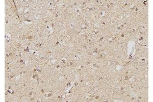 ABIN6261810 and ABIN6268934 at 1/100 staining Human brain tissue by IHC-P.