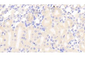 Detection of a4GALT in Mouse Kidney Tissue using Polyclonal Antibody to Alpha-1,4-Galactosyltransferase (a4GALT) (A4GALT 抗体  (AA 94-270))