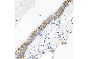 Immunohistochemistry of paraffin-embedded human lung using ACVR2A antibody at dilution of 1:100 (x40 lens). (ACVR2A 抗体)