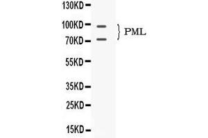 Western blot analysis of PML Protein expression in mouse testis extract ( Lane 1). (PML 抗体  (N-Term))