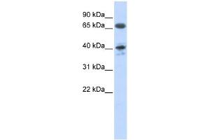 AGTR1 antibody used at 1 ug/ml to detect target protein. (Angiotensin II Type-1 Receptor 抗体  (N-Term))