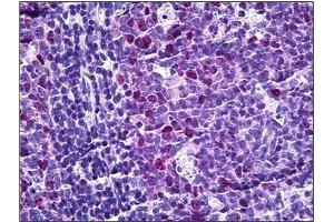Human Tonsil: Formalin-Fixed, Paraffin-Embedded (FFPE) (TPX2 抗体  (Internal Region))