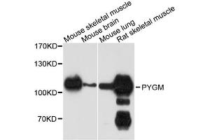 Western blot analysis of extracts of various cell lines, using PYGM antibody.