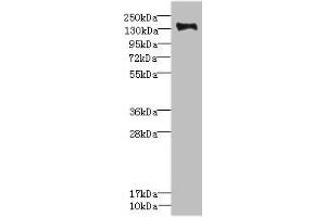 Western blot All lanes: PLXNB2 antibody IgG at 2. (Plexin B2 抗体  (AA 1080-1200))