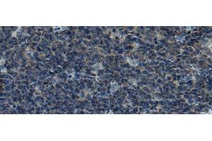 Immunohistochemistry of paraffin-embedded Human tonsil tissue using CUL5 Polyclonal Antibody at dilution of 1:55(x200) (Cullin 5 抗体)