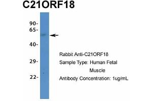 Host:  Rabbit  Target Name:  C21ORF18  Sample Type:  Human Fetal Muscle  Antibody Dilution:  1. (SETD4 抗体  (C-Term))