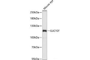 Western blot analysis of extracts of Mouse eye using GUCY2F Polyclonal Antibody at dilution of 1:1000. (GUCY2F 抗体)