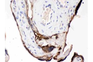 CDCP1 was detected in paraffin-embedded sections of human placenta tissues using rabbit anti- CDCP1 Antigen Affinity purified polyclonal antibody (Catalog # ) at 1 µg/mL. (CDCP1 抗体  (AA 582-667))