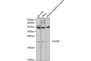Western blot analysis of extracts of various cell lines, using HSPB2 antibody (ABIN6131082, ABIN6142054, ABIN6142055 and ABIN6219505) at 1:1000 dilution. (HSPB2 抗体  (AA 1-182))