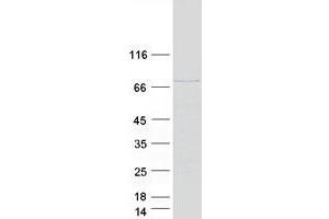 Western Blotting (WB) image for Cell Division Cycle 16 Homolog (S. Cerevisiae) (CDC16) (Transcript Variant 1) protein (Myc-DYKDDDDK Tag) (ABIN2713828)