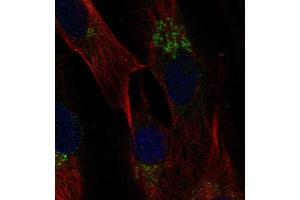 Immunofluorescent staining of human cell line BJ shows localization to the Golgi apparatus. (CCL2 抗体  (AA 25-99))