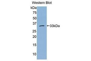 Western Blotting (WB) image for anti-Bleomycin Hydrolase (BLMH) (AA 213-447) antibody (ABIN1175598) (BLMH 抗体  (AA 213-447))
