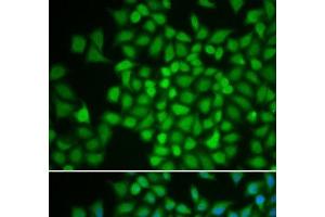 Immunofluorescence analysis of HeLa cells using COPS5 Polyclonal Antibody (COPS5 抗体)