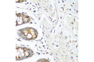Immunohistochemistry of paraffin-embedded human colon using FLT4 antibody (ABIN5973266) at dilution of 1/200 (40x lens).