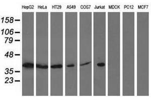 Image no. 2 for anti-Acetyl-CoA Acetyltransferase 2 (ACAT2) antibody (ABIN1496405) (ACAT2 抗体)