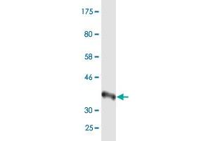 Western Blot detection against Immunogen (37. (RECQL2 抗体  (AA 1322-1432))