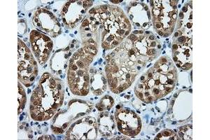 Immunohistochemical staining of paraffin-embedded prostate tissue using anti-TPMT mouse monoclonal antibody. (TPMT 抗体)