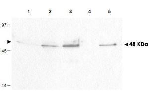 Western blot using CCNB1 (phospho S126) polyclonal antibody  shows detection of a band ~48 kDa corresponding to phosphorylated human CCNB1 (arrowheads) in various whole cell lysates. (Cyclin B1 抗体  (pSer126))