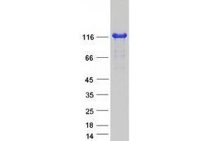 Western Blotting (WB) image for Actin Filament Associated Protein 1-Like 2 (AFAP1L2) (Transcript Variant 2) protein (Myc-DYKDDDDK Tag) (ABIN2714446)