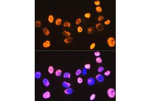Immunofluorescence analysis of HeLa cells using DDX5 Rabbit mAb (ABIN7266698) at dilution of 1:100 (40x lens). (DDX5 抗体)