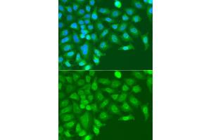 Immunofluorescence analysis of A549 cell using TARBP2 antibody. (TRBP 抗体)