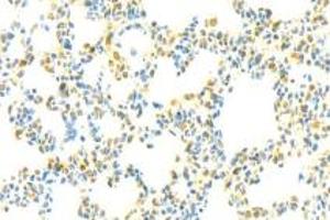 Immunohistochemistry analysis of paraffin-embedded rat lung using ADAMTS4 (ABIN7072947) at dilution of 1: 3000