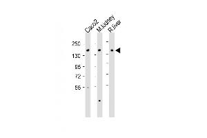 All lanes :ATP7B Antibody (C-term) at 1:2000 dilution Lane 1: Caco2 whole cell lysate Lane 2: Mouse kidney lysate Lane 3: Rat liver lysate Lysates/proteins at 20 μg per lane.