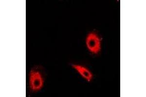 Immunofluorescent analysis of TIM staining in Hela cells. (TPI1 抗体)