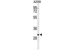 Western blot analysis of BASP1 Antibody (Center) in A2058 cell line lysates (35µg/lane).