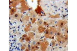 Used in DAB staining on fromalin fixed paraffin-embedded Liver tissue (PSMD10 抗体  (AA 1-226))