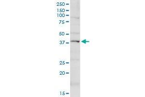Western Blotting (WB) image for anti-Potassium Intermediate/small Conductance Calcium-Activated Channel, Subfamily N, Member 4 (KCNN4) (AA 1-427) antibody (ABIN948056)
