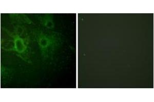 Immunofluorescence analysis of HeLa cells, using HCK (Phospho-Tyr410) Antibody. (HCK 抗体  (pTyr410))