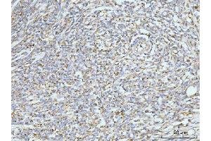 IHC analysis of GRPEL1 using anti-GRPEL1 antibody (ABIN7602643). (GRPEL1 抗体  (AA 90-217))