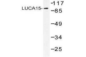 Western blot (WB) analysis of LUCA15 antibody in extracts from HHUVEC cells. (RBM5 抗体)