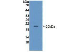 Detection of Recombinant GABPa, Human using Polyclonal Antibody to GA Binding Protein Transcription Factor Alpha (GABPa) (GABPA 抗体  (AA 168-314))