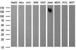Image no. 2 for anti-Protein tyrosine Phosphatase, Receptor Type, C (PTPRC) antibody (ABIN1497330) (CD45 抗体)