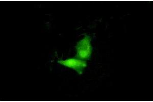 Figure:FITC staining on IHC-P;Simple: A549 cells (IRF6 抗体  (AA 196-445))