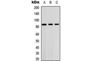 Western blot analysis of SGK1/2 (pT256/253) expression in HEK293T (A), Jurkat (B), NIH3T3 (C) whole cell lysates. (SGK1/2 (pSer253), (pSer256) 抗体)