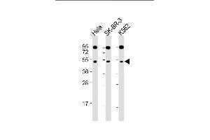 All lanes : Anti-SLC16A13 Antibody (C-term) at 1:2000 dilution Lane 1: Hela whole cell lysate Lane 2: SK-BR-3 whole cell lysate Lane 3: K562 whole cell lysate Lysates/proteins at 20 μg per lane.