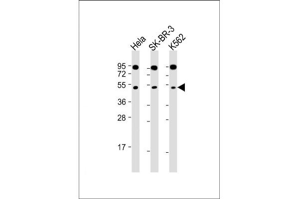 SLC16A13 anticorps  (C-Term)