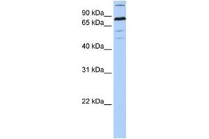 Human 721_B; WB Suggested Anti-ZNF700 Antibody Titration: 0. (ZNF700 抗体  (C-Term))