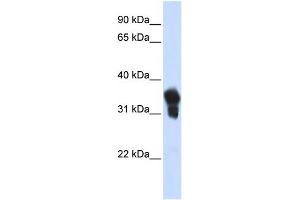 WB Suggested Anti-MLX Antibody Titration:  0. (MLX 抗体  (N-Term))