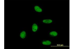 Immunofluorescence of purified MaxPab antibody to ZNF496 on HeLa cell. (ZNF496 抗体  (AA 1-587))