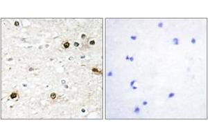 Immunohistochemistry analysis of paraffin-embedded human brain tissue, using NAB2 Antibody. (NAB2 抗体  (AA 261-310))