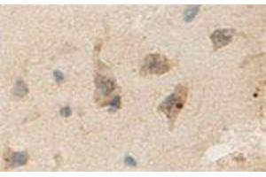 Immunohistochemical staining of formalin-fixed paraffin-embedded human brain showing staining with ANLN polyclonal antibody  at 1:100 dilution. (Anillin 抗体)