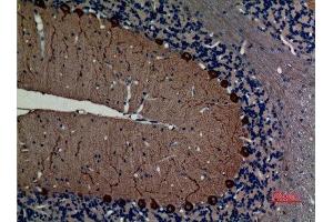 Immunohistochemistry (IHC) analysis of paraffin-embedded Rat Brain, antibody was diluted at 1:100. (NEFL 抗体  (C-Term))
