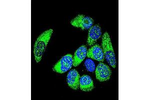 Confocal immunofluorescent analysis of WT1 Antibody (Center ) (ABIN655904 and ABIN2845304) with MCF-7 cell followed by Alexa Fluor® 488-conjugated goat anti-rabbit lgG (green). (WT1 抗体  (AA 346-375))