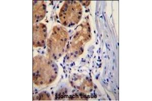 CTNB1 Antibody (C-term) (ABIN655178 and ABIN2844795) immunohistochemistry analysis in formalin fixed and paraffin embedded human stomach tissue followed by peroxidase conjugation of the secondary antibody and DAB staining. (CTNNB1 抗体  (C-Term))