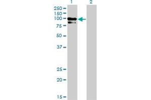 Western Blotting (WB) image for anti-Oculocerebrorenal Syndrome of Lowe (OCRL) (AA 146-239) antibody (ABIN518503)